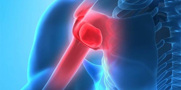 Shoulder Flexibility Solution Survey